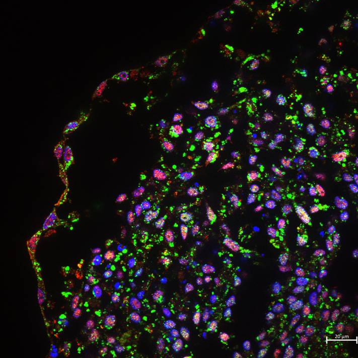 Lung epithelial spheroid