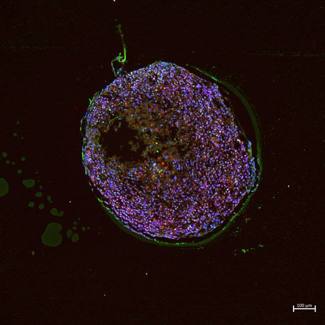 Lung epithelial spheroid